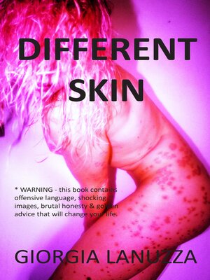 cover image of Different Skin